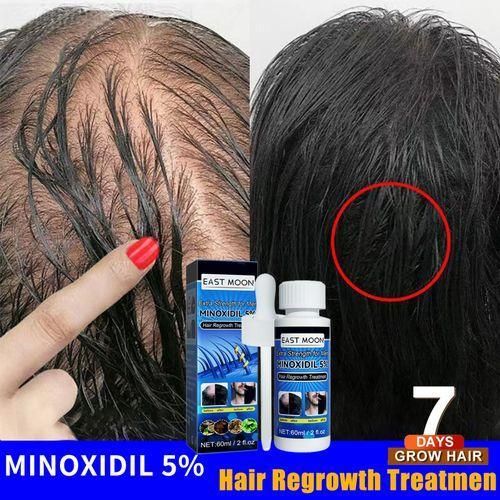 Minoxidil Hair Regrowth - Hair Improver - Beard And Hair Growth