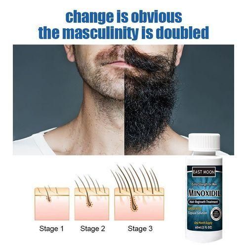 Minoxidil Hair Regrowth - Hair Improver - Beard And Hair Growth