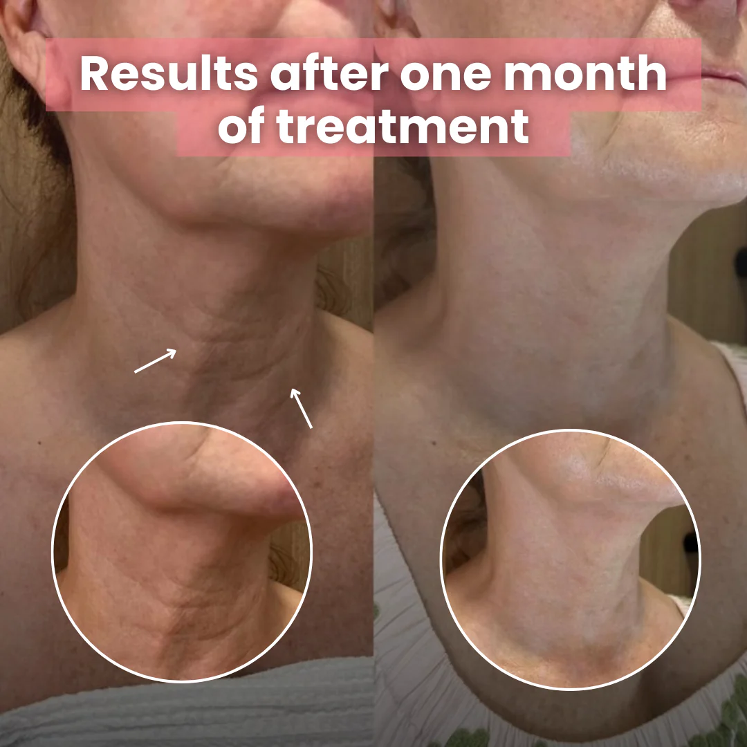 Korean Bio-Collagen Necklift Mask - Younger Neck After 1 Use