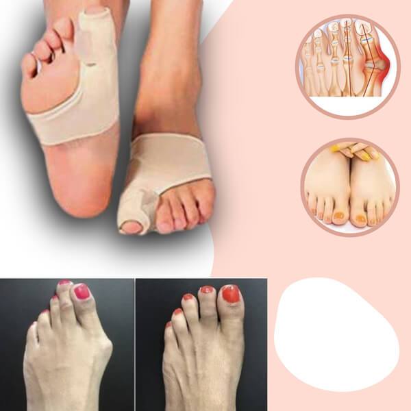 FeelGreat Orthopedic Toe Bunion Corrector